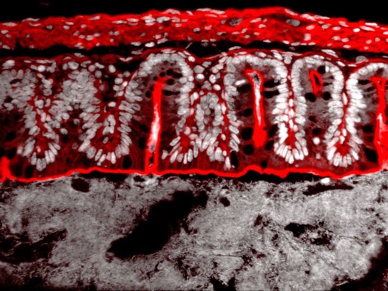 Visualization of the intestinal mucosa. Fluorescence microscopy of an intestinal biopsy.